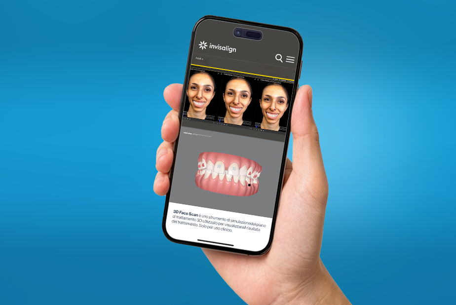 Il futuro della pianificazione ortodontica prende forma con il 3D Face Scan di Align Technology