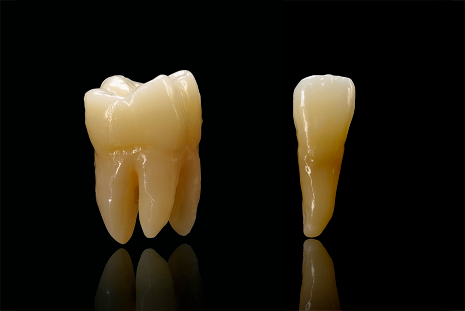 Primo piano di due denti 