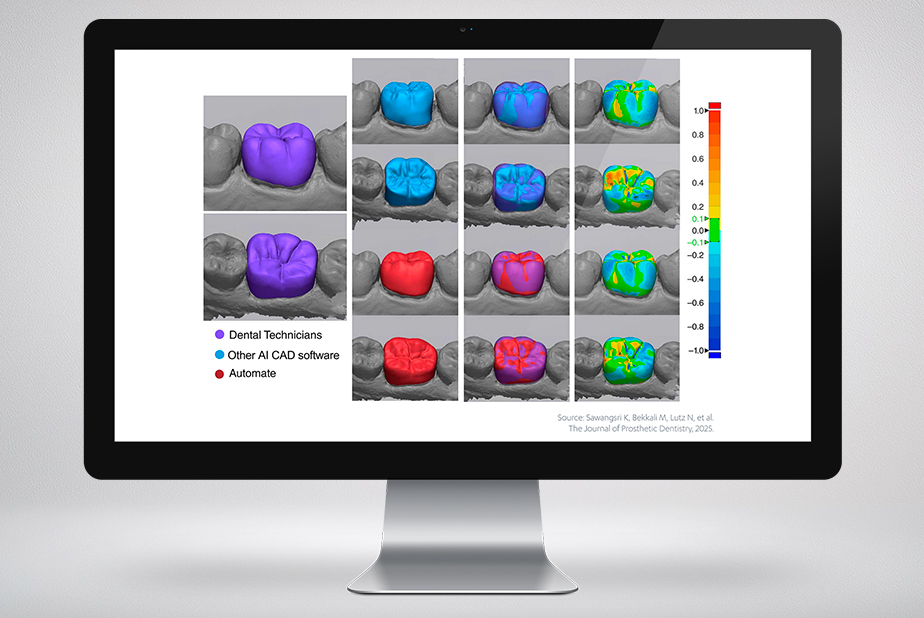 3Shape Automate in Dental System: l'intelligenza artificiale che evolve il laboratorio odontotecnico