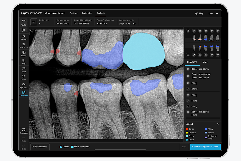 Aumenta il tuo potenziale diagnostico con Align X-ray Insights