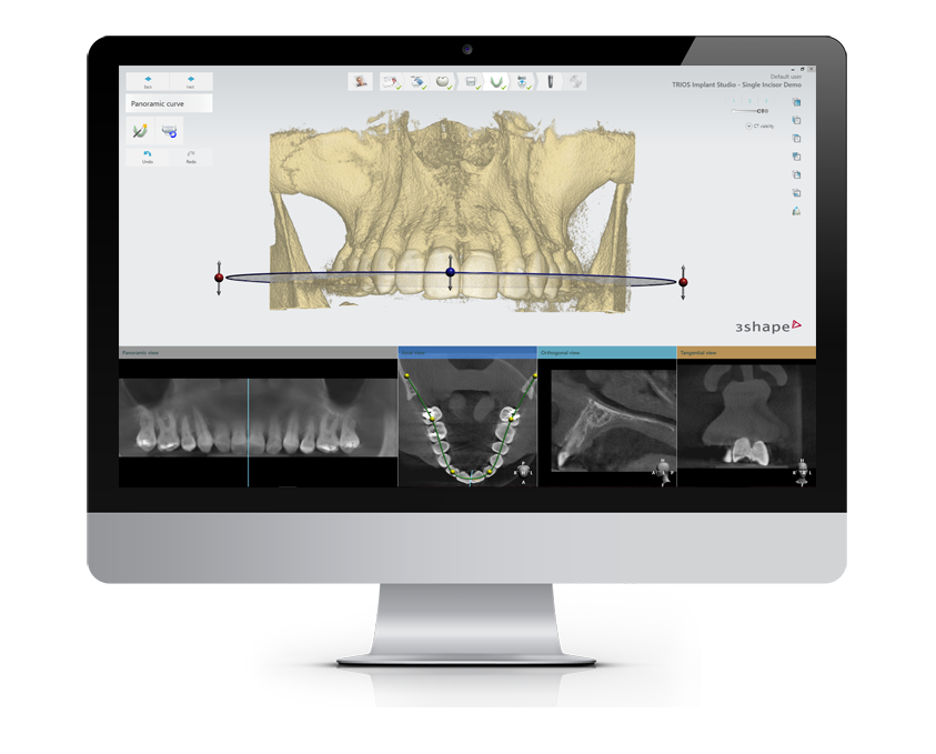 Implant Studio