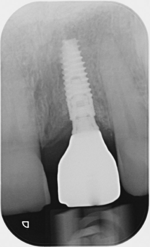 fig.20