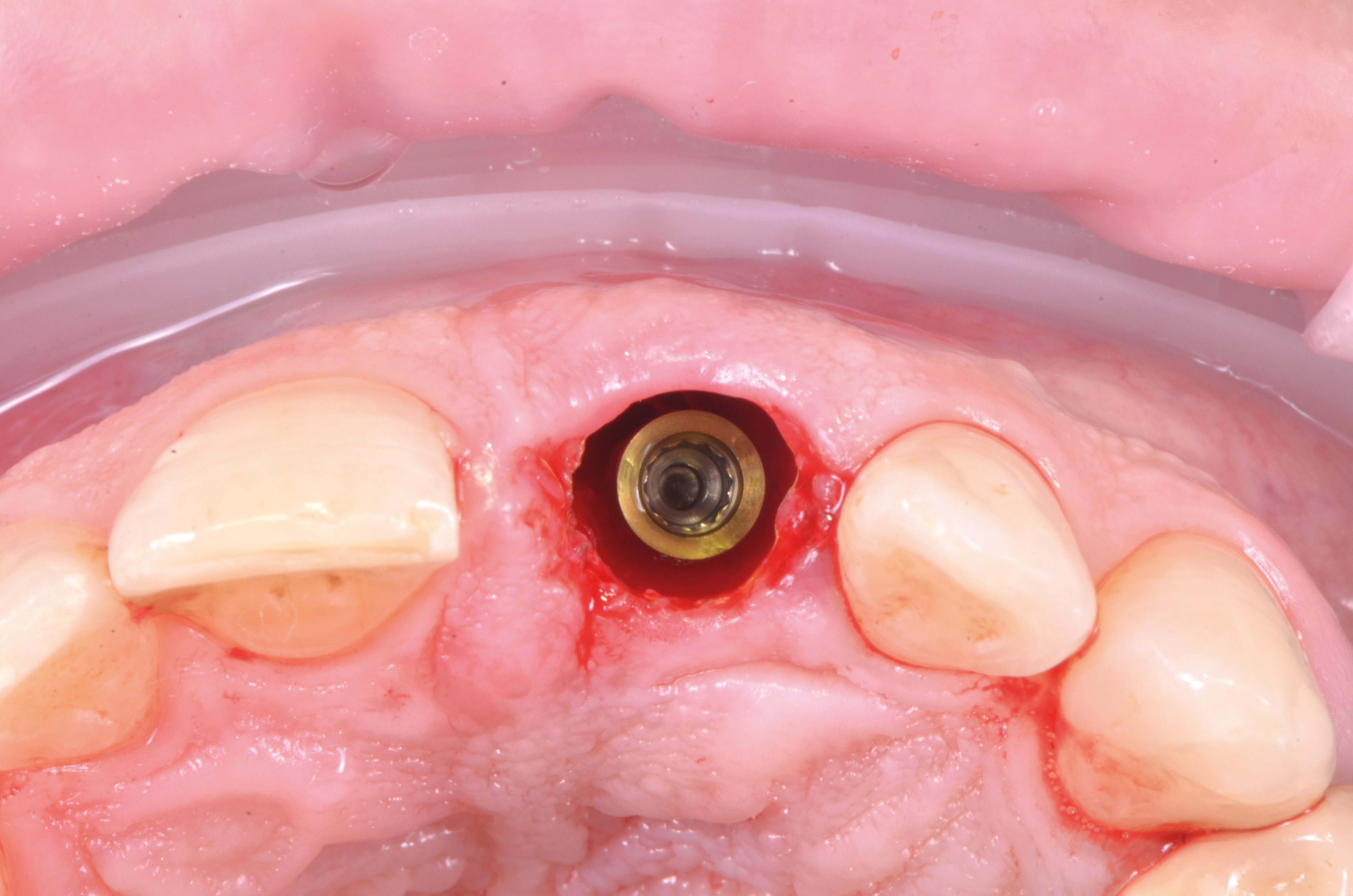 fig.9