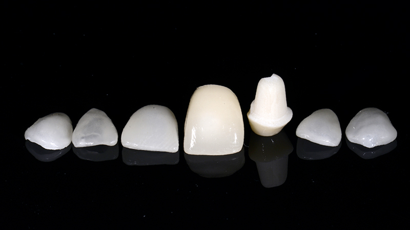 Denti lucidati