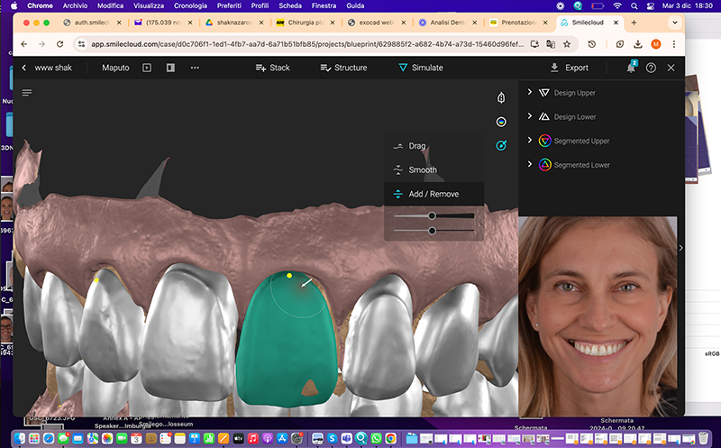 anatomie 3D