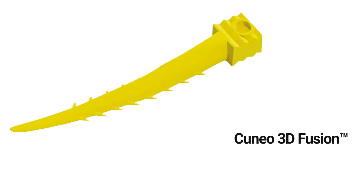 Cuneo 3D Fusion