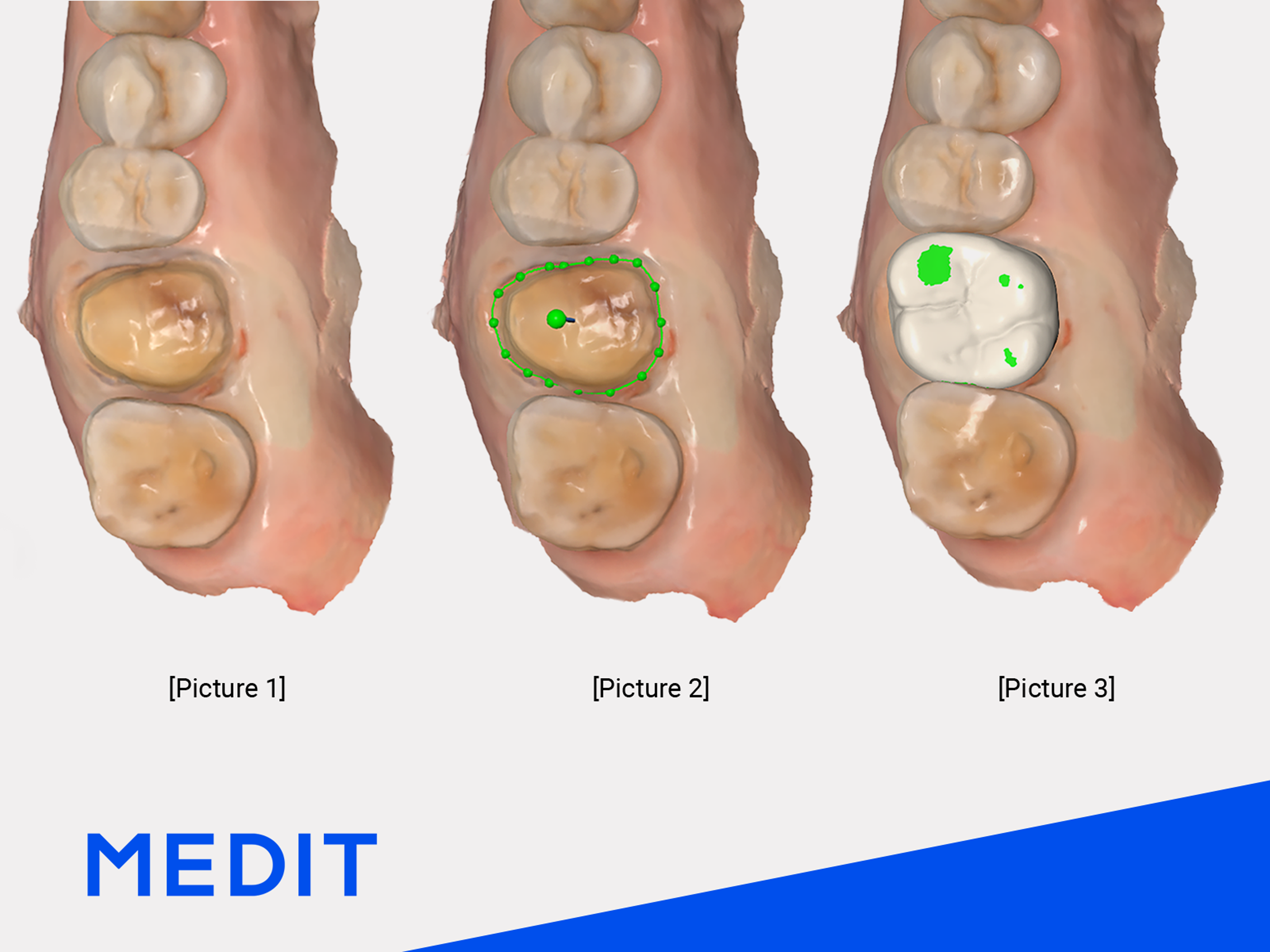 rilevazione denti target