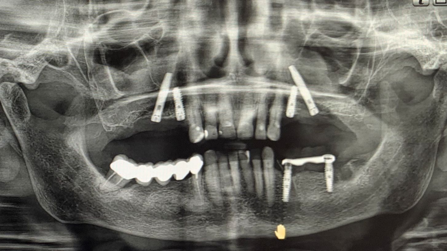 Fig. 6 - Immagini intraoperatorie