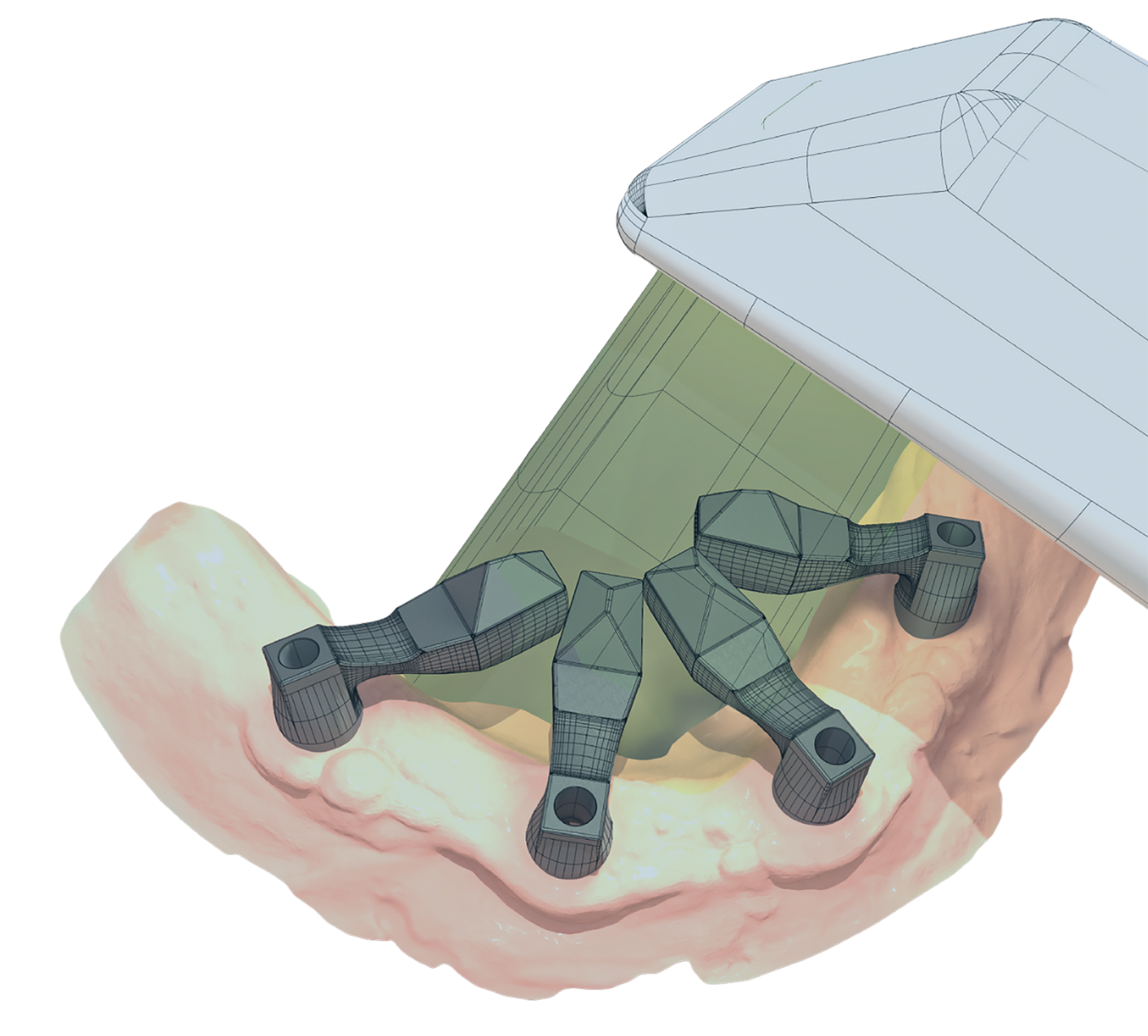 Fig. 5 - Protocollo ScanLogiQ