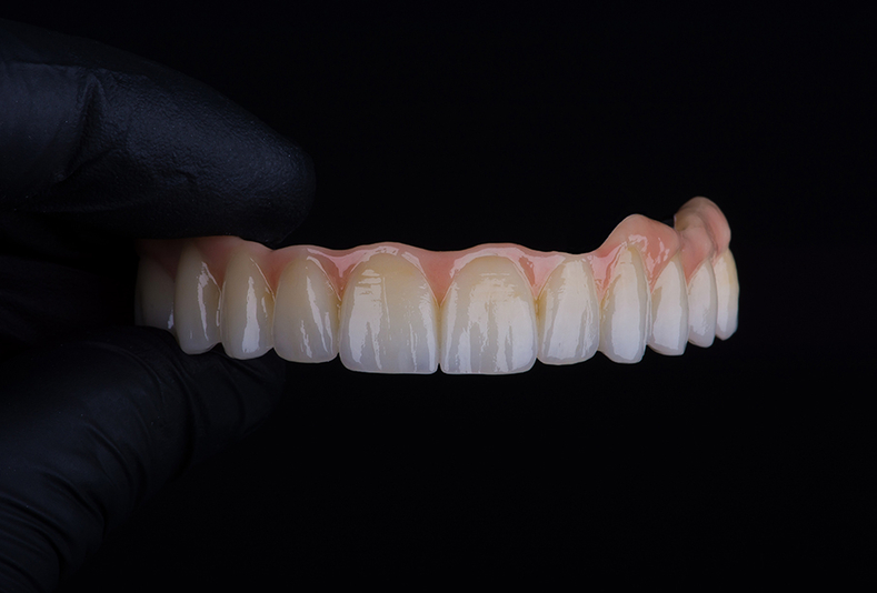 Denti in primo piano 