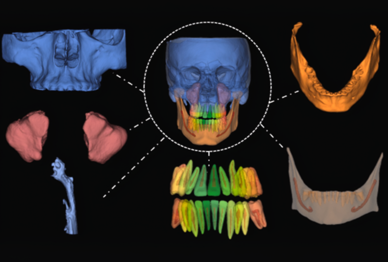 CBCT 