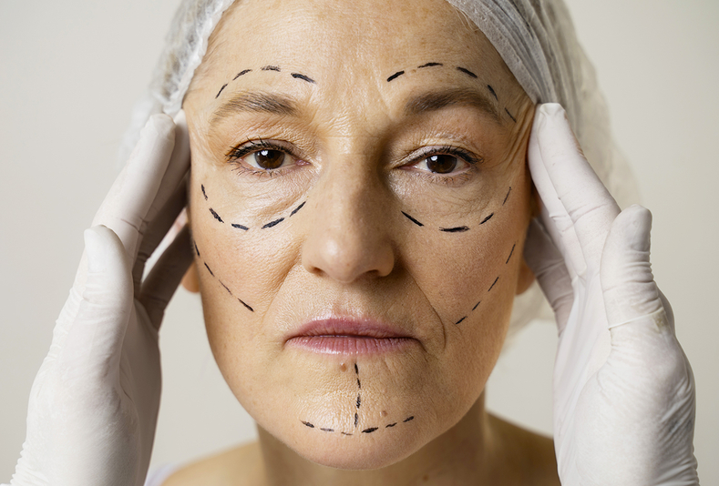 Volto di donna in primo piano con segni per trattamenti di medicina estetica
