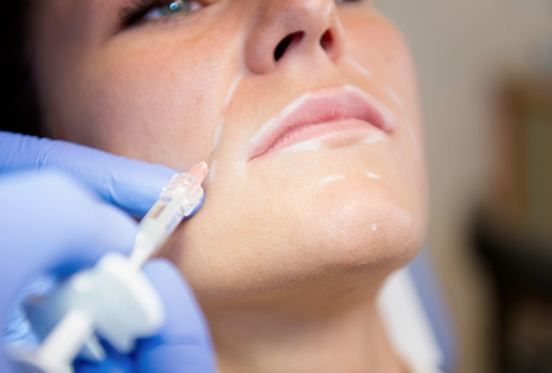 donna che si sottopone a iniezione di filler sul viso
