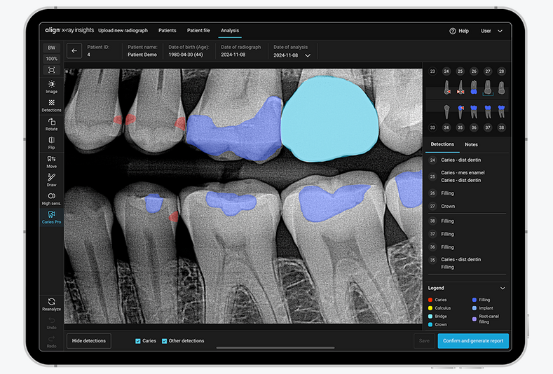 Align X-ray Insights