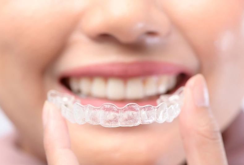 Aligner trasparenti