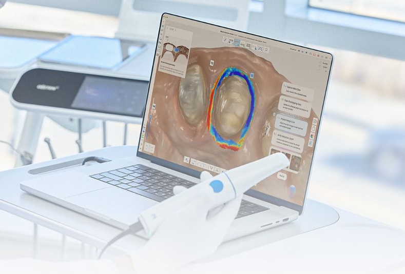 Scanner intraorale e pc
