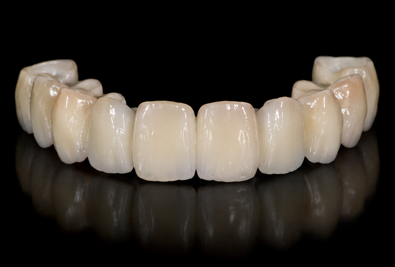 Protesi in ceramica integrale