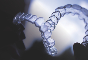 Il trattamento ortodontico dei pazienti in crescita: un’opportunità di sviluppo ed ottimizzazione della gestione di studio