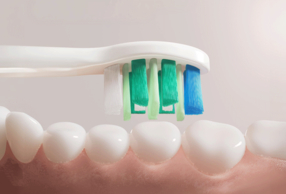 Philips Sonicare: 5 consigli per una pulizia dei denti efficace