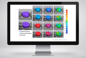 3Shape Automate in Dental System