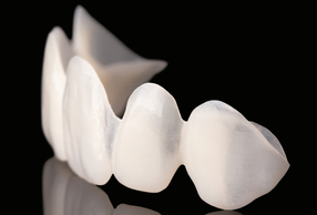 Mock-up digitale e Multistratum Flexible: pianificazione che diventa realtà Multistratum Flexible