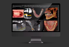 DTX Studio Clinic Dexis