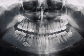 Radiografia