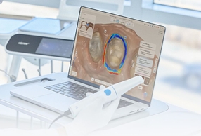 Scanner intraorale e pc
