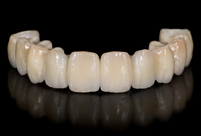 Protesi in ceramica integrale