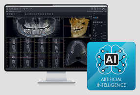 Simbolo AI e monitor PC con schermata software cbct