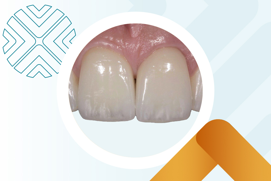 Tecnodental Forum 2024: un’occasione da non perdere locandina tecnodental forum
