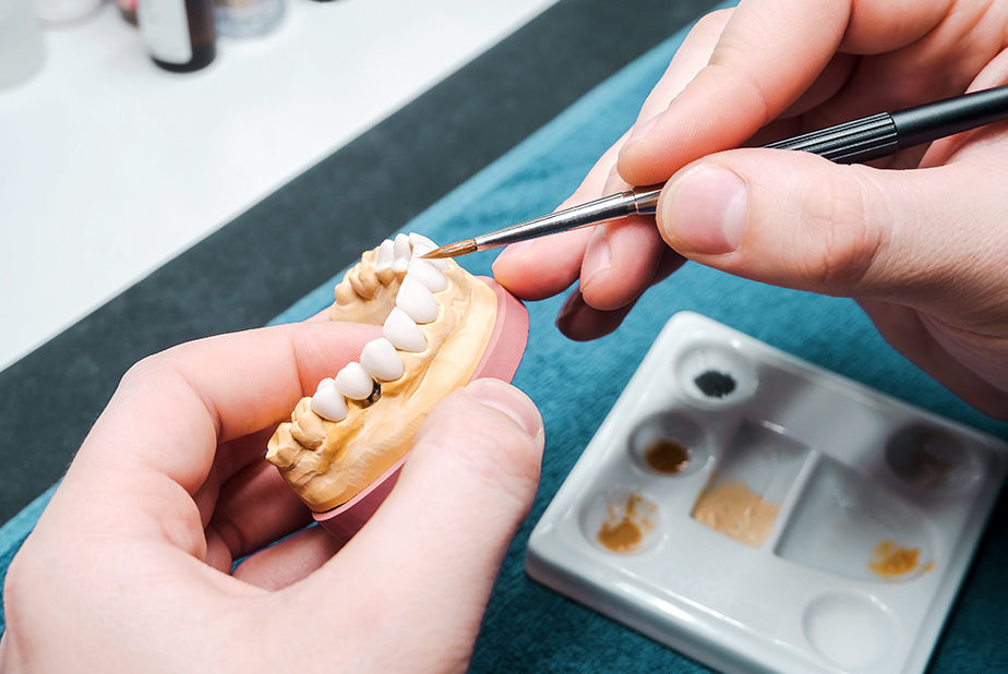 odontotecnico lavora su una protesi