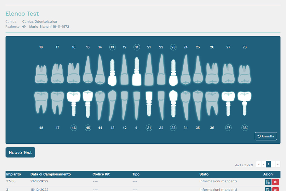Prebiomics Implant Test: individuazione precoce delle malattie implantari grafica del test