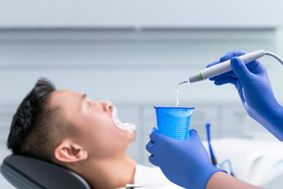 Ivoclar presenta una vera innovazione per la seduta di igiene dentale Ivoclar VivaDent Aerosol Reduction Gel
