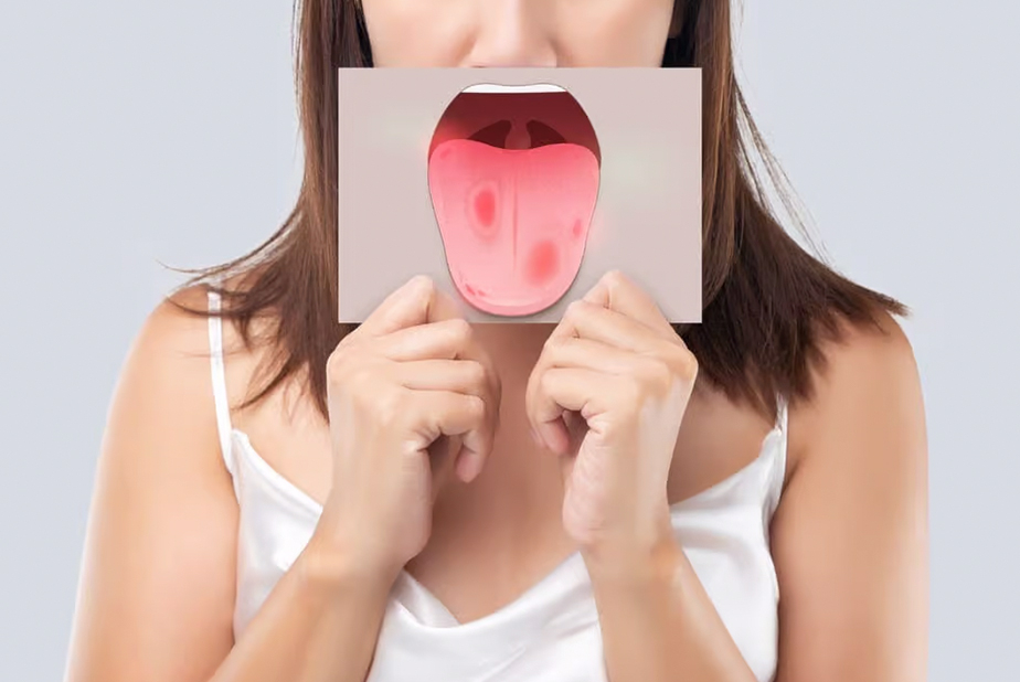 Candidosi orale: un approfondimento Donna con illustrazione di bocca arrossata