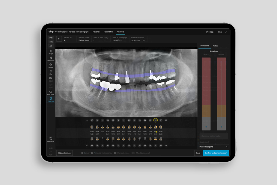 Align X-ray Insights il nuovo software di rilevamento computerizzato supportato da AI Align X-ray Insights