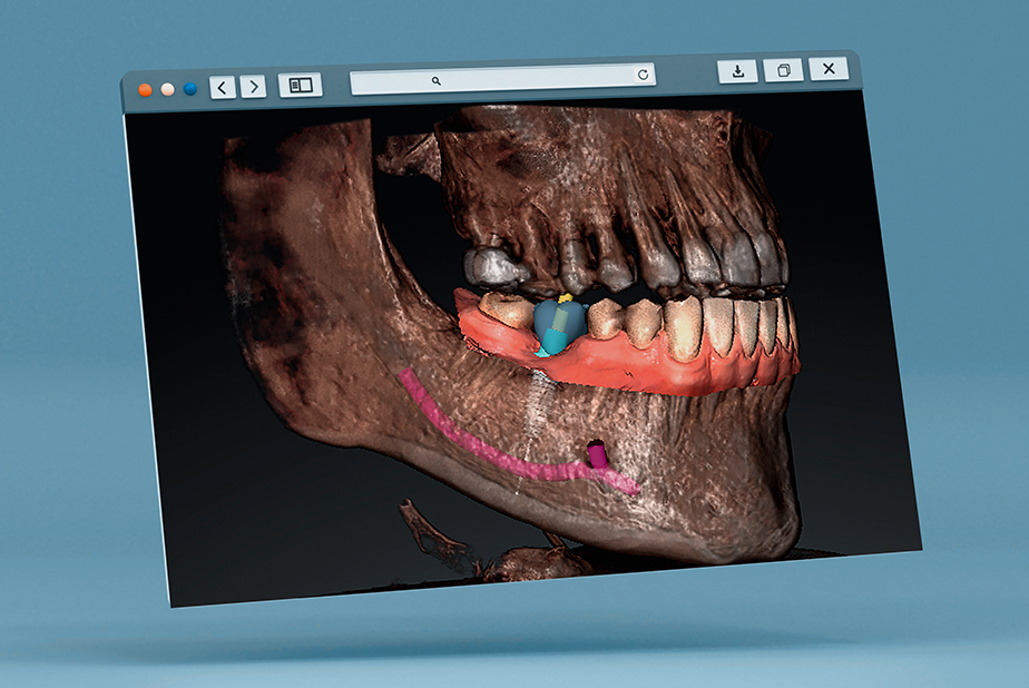 Dürr Dental a Expodental 2025: tecnologia, innovazione e un anniversario da celebrare insieme radiografia