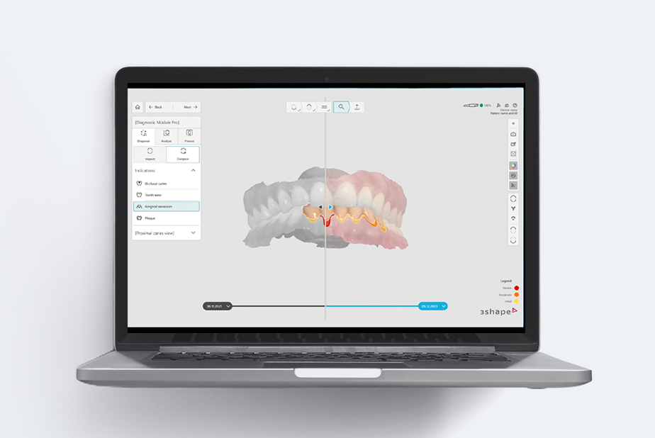 TRIOS DX Plus: la nuova era dell'odontoiatria digitale TRIOS DX Plus screen