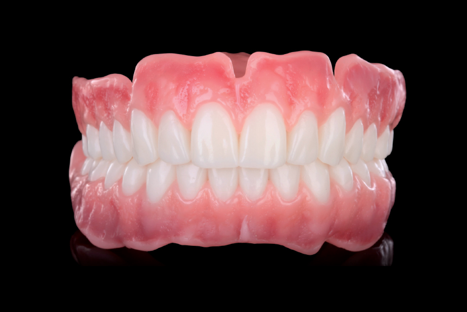 Protesi totali in resina realizzate con l'innovativo Florence Totalprox Denture System Florence Totalprox Denture System