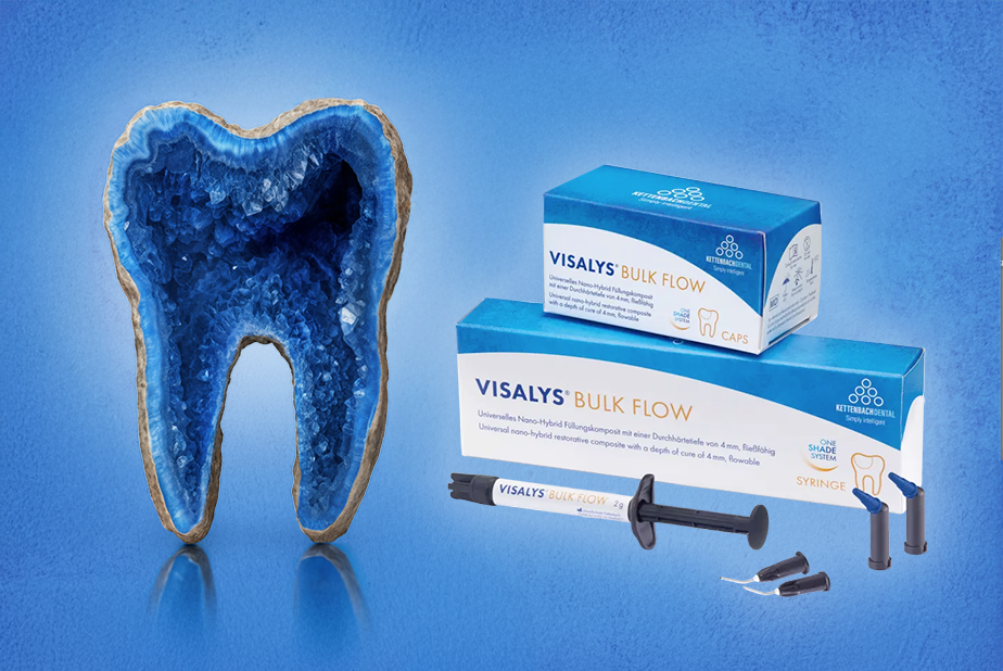 Visalys Bulk Flow: scorre perfettamente, modella con precisione Visalys Bulk Flow Kettenbach Dental