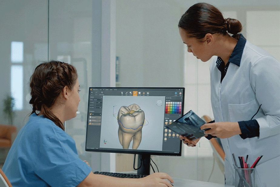 L'influenza dei software di progettazione digitale sulle corone dentali specialisti con pc che progettano corone dentali