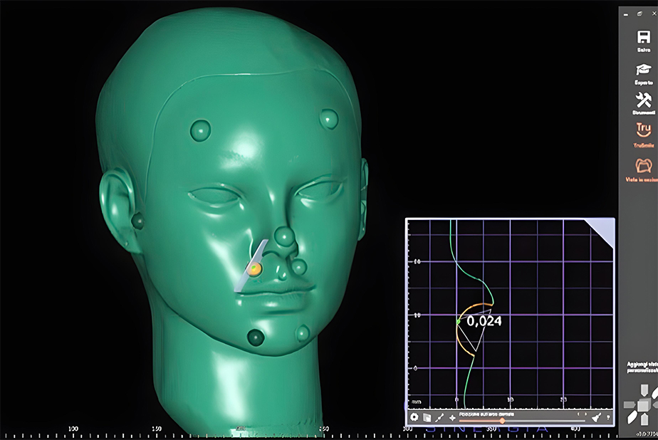 Scanner facciali 3D: quanto sono affidabili nel workflow odontoiatrico? scanner facciale 3D