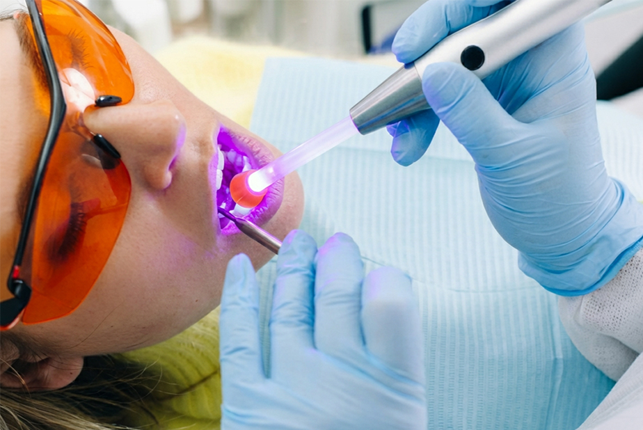 Sbiancamento dentale con MnO_BioS e LED viola Paziente che effettua sbiancamento con LED