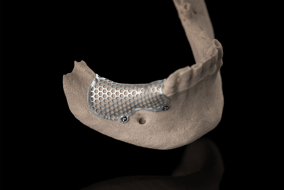 3D-Mesh custom di BTK 3D-Mesh custom di BTK