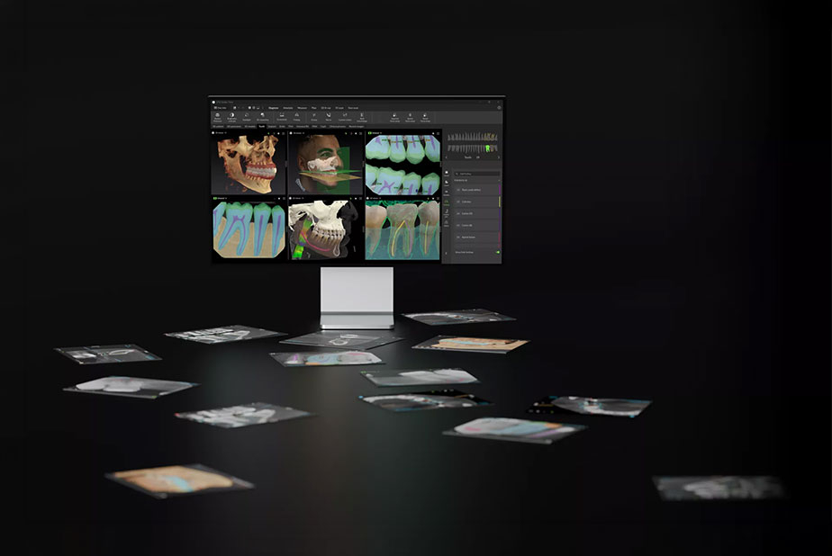 DEXIS stabilisce un nuovo standard per l'odontoiatria digitale con IA avanzata e connettività integrata DEXIS DTX Studio Clinic
