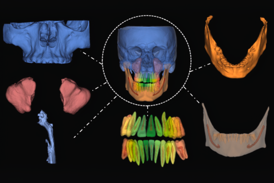 La CBCT nel workflow digitale: linee guida, paramteri di acquisizione e innovazioni tecnologiche CBCT