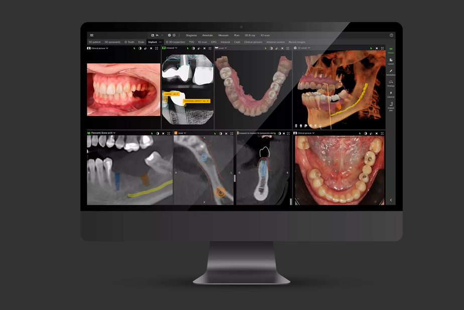 DTX Studio Clinic Dexis