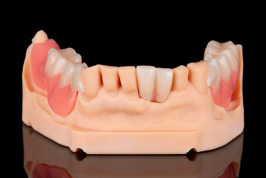 Flexmon Partials Zirkonzahn