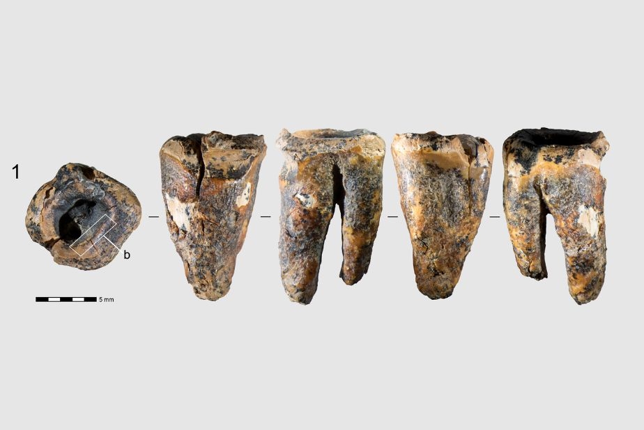 I Neanderthal praticavano cure odontoiatriche complesse già 60.000 a Denti Neanderthal