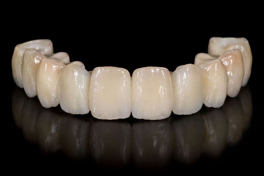 Protesi in ceramica integrale